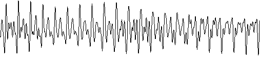 quasiperiodic_waveform Quasiperiodic waveform